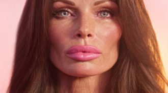 SKINbling-Filler3-300